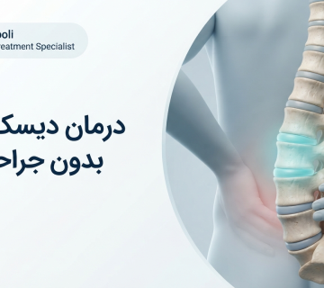 آناتومی فتق دیسک کمر و فشار روی عصب سیاتیک