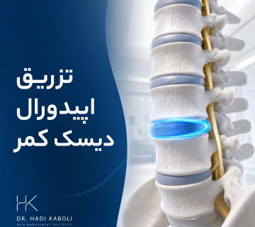 تزریق اپیدورال دیسک کمر
