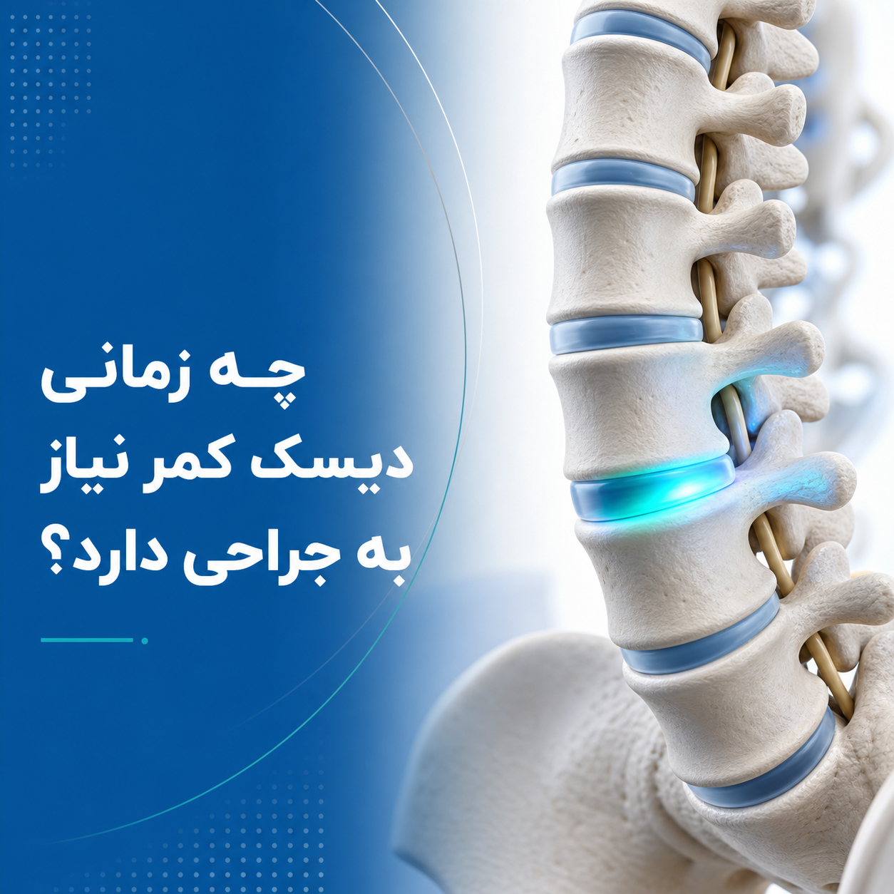 چه زمانی دیسک کمر نیاز به جراحی دارد