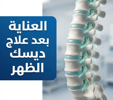 العناية بعد علاج ديسك الظهر