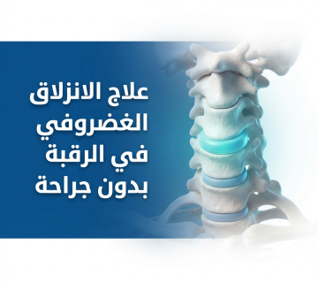 علاج الانزلاق الغضروفي في الرقبة بدون جراحة