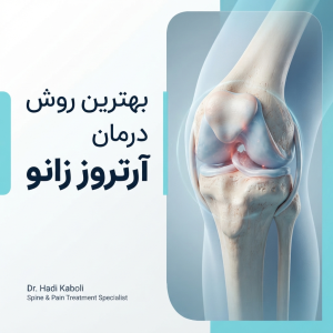 بهترین روش درمان آرتروز زانو