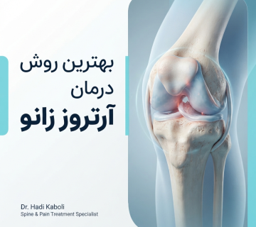 بهترین روش درمان آرتروز زانو