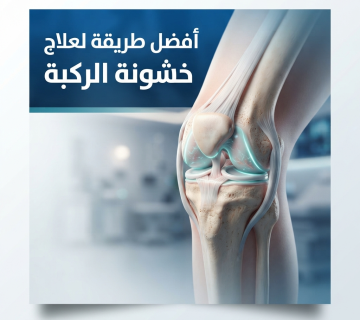 أفضل علاج لخشونة الركبة