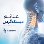 علائم دیسک گردن