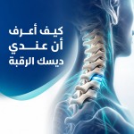 كيف أعرف أن عندي ديسك الرقبة