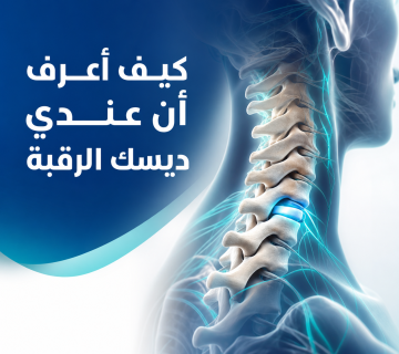 كيف أعرف أن عندي ديسك الرقبة