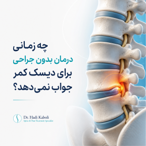 شکست درمان غیرجراحی دیسک کمر