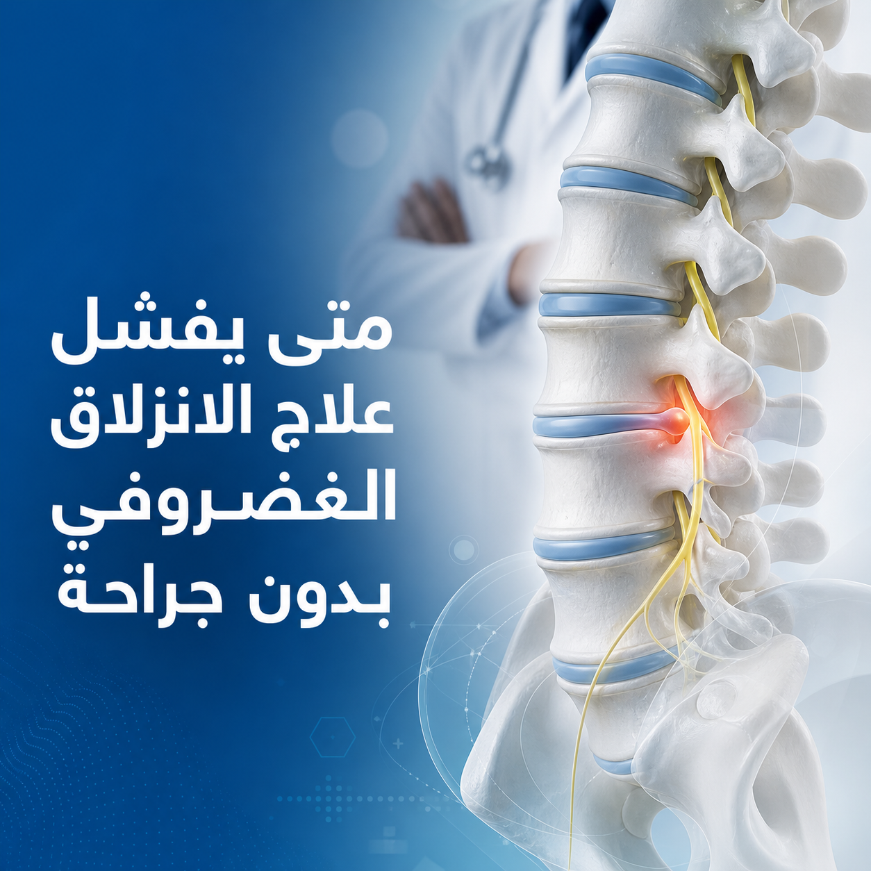 متى يفشل علاج الانزلاق الغضروفي بدون جراحة