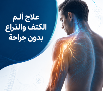 علاج ألم الكتف والذراع بدون جراحة