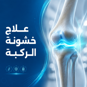 علاج خشونة الركبة