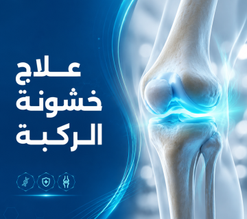 علاج خشونة الركبة