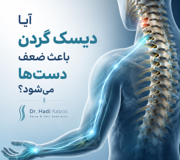 ضعف دست در دیسک گردن