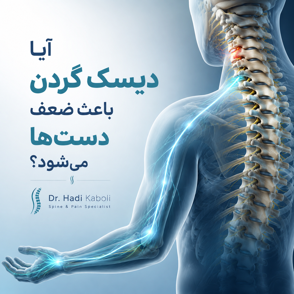 ضعف دست در دیسک گردن