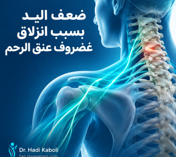 ضعف اليد بسبب انزلاق غضروف عنق الرحم