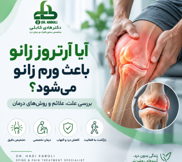 ورم زانو در آرتروز