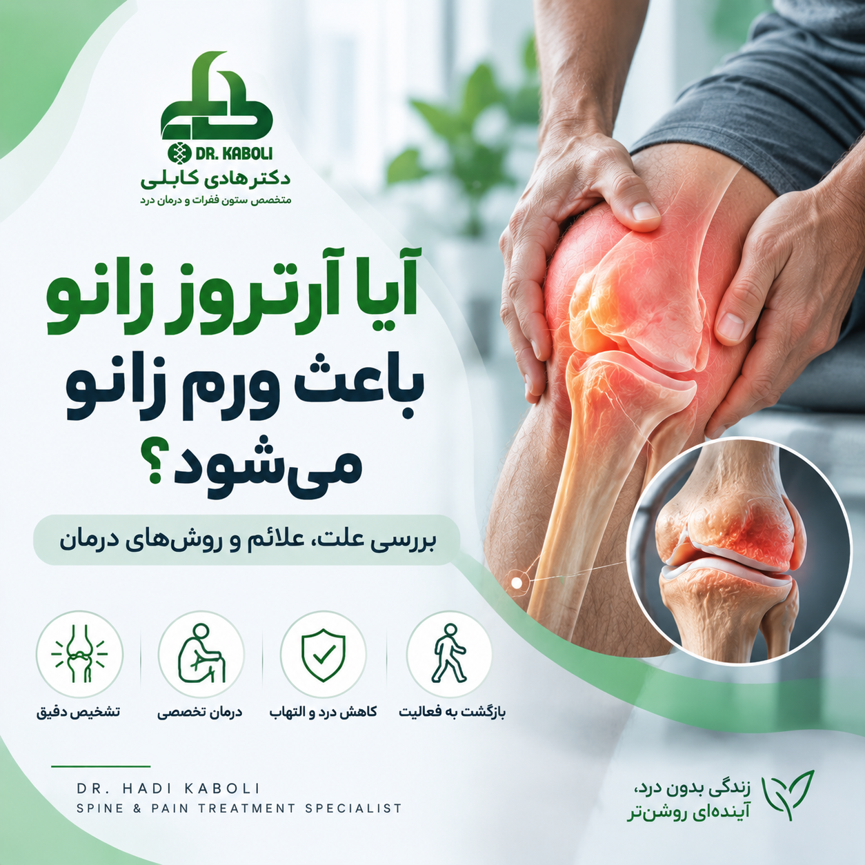ورم زانو در آرتروز