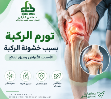 تورم الركبة بسبب خشونة الركبة