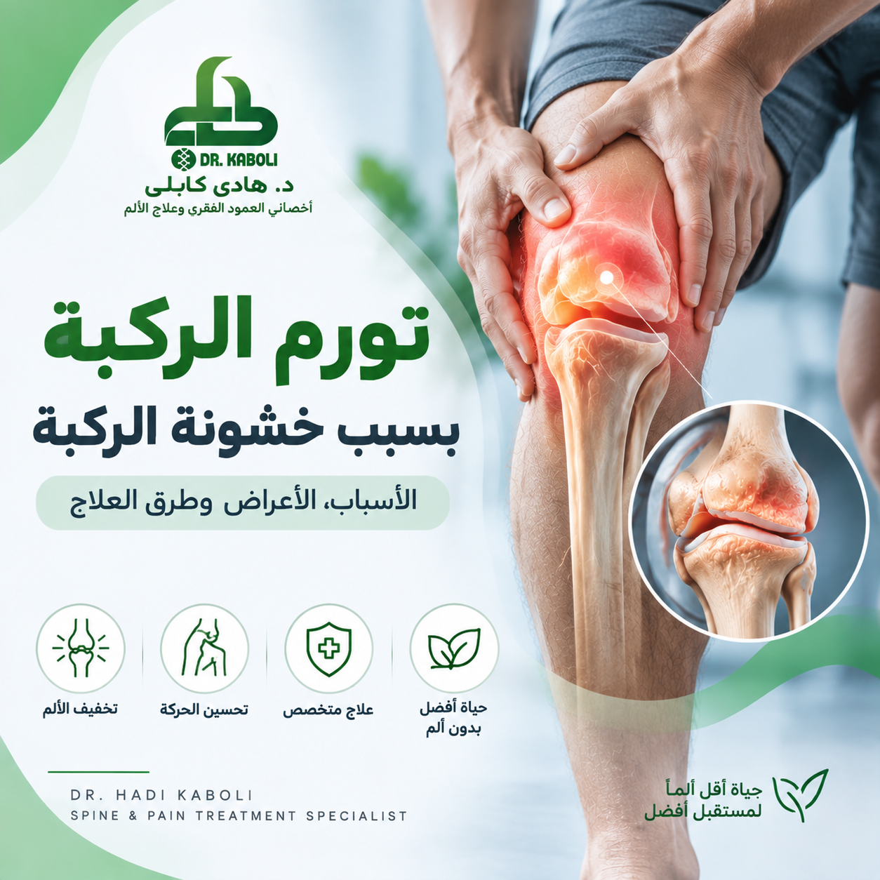 تورم الركبة بسبب خشونة الركبة