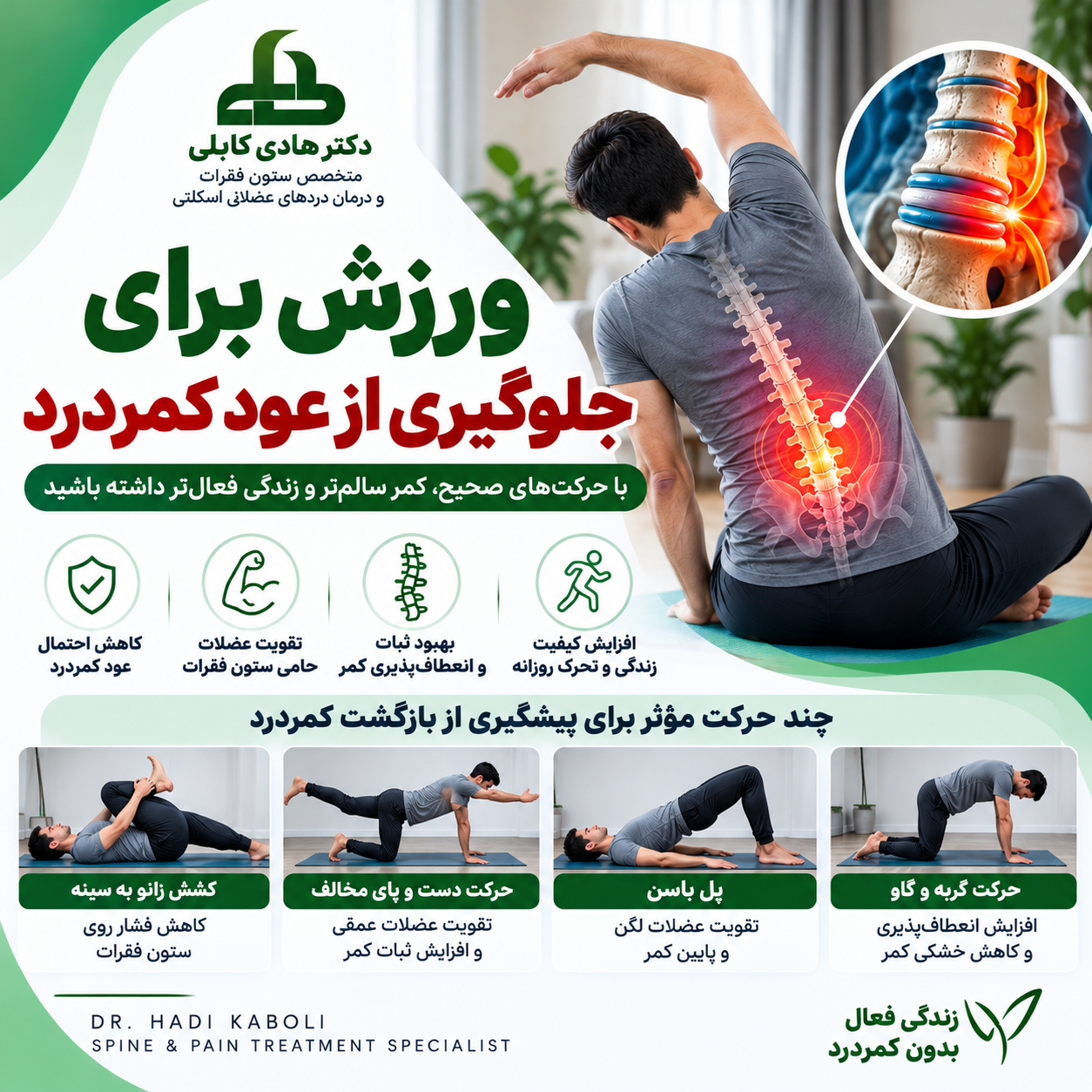 ورزش برای جلوگیری از عود کمردرد